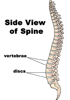 ACE - ProSource™: June 2014 - Herniated Discs: What Can a Fitness ...